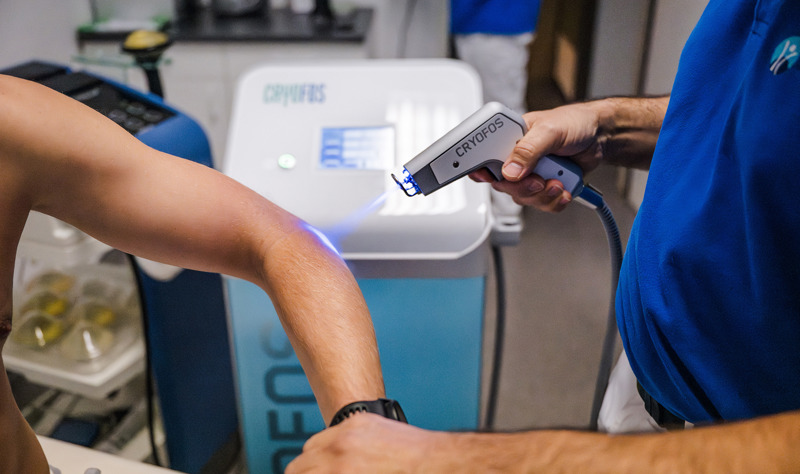 Kryotherapie (mit Cryofos)